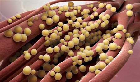 Closeup 3D rendering of staphylococcus aureus, a serious infection linked to Bair Hugger devices