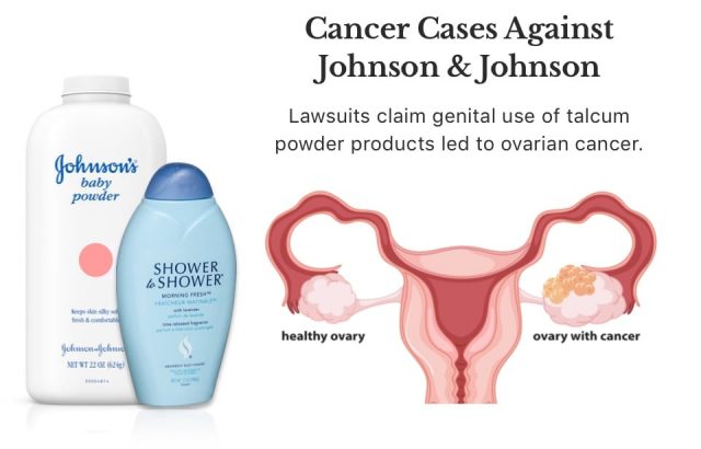 ovarian cancer from talcum powder