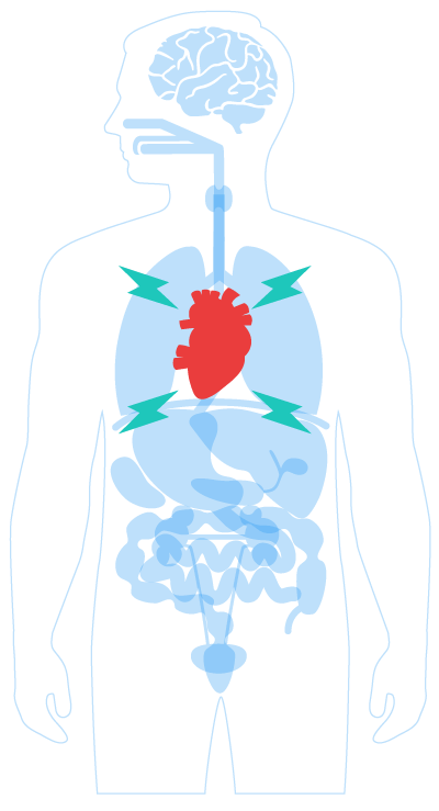 Are there any side effects associated with treatment of fluid around the heart?