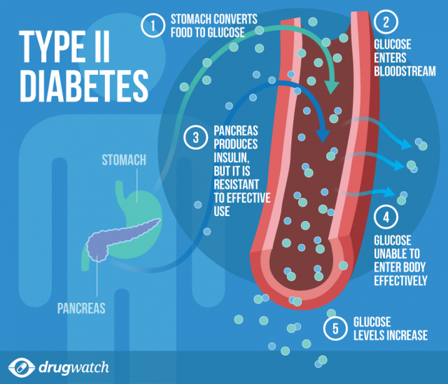 What is Type 2 Diabetes