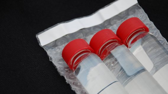 Water samples ready for testing
