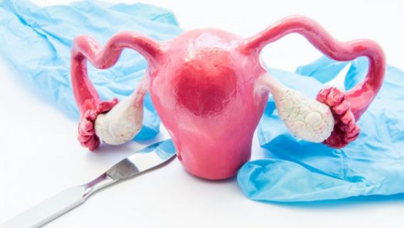 The Jury Is Still Out on Safety of Essure Birth Control