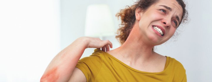 Woman with heat rash flaring up on her neck
