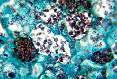 Histoplasmosis on a Cellular Level