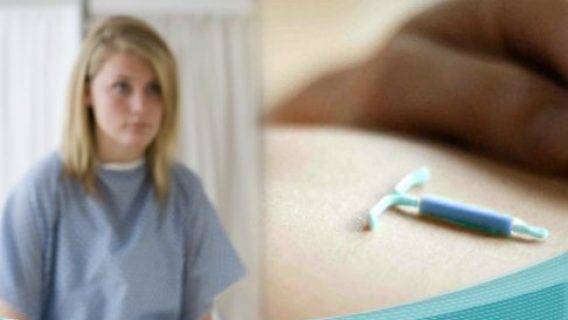 IUD Birth Control Like Mirena and Skyla Are Safe for Teens, Study Says