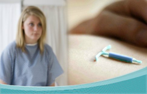 Teen IUD Birth Control Study teenage girl wearing a hospital gown and an IUD device