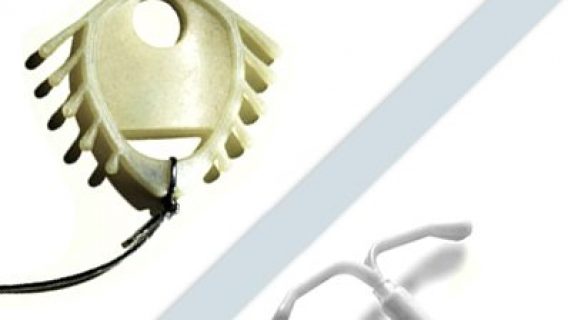 Mirena IUD Litigation Revives Memories of Dalkon Shield Injuries