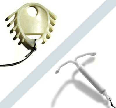 Mirena IUD and Dalkon Shield Injuries Mirena IUD and Dalkon Shield devices