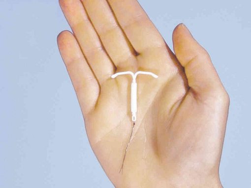 Mirena IUD Mirena IUD in hand