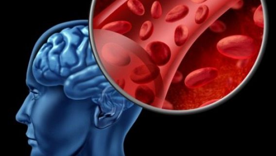Study: Antidepressants Increase Risk of Bleeding in the Brain and Stroke