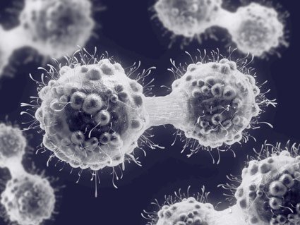 cancer cells Bladder cancer cells