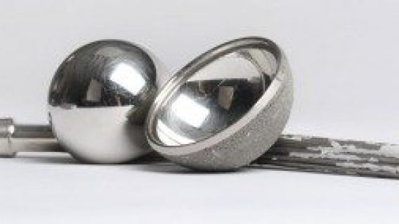 Reasons to Keep Your Implant After Revision Surgery