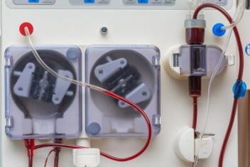 Dialysis Machine