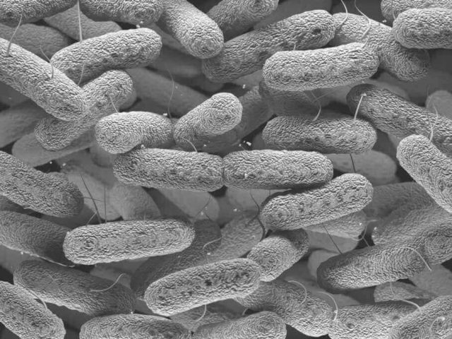 Microscopic view of enterobacteriaceae