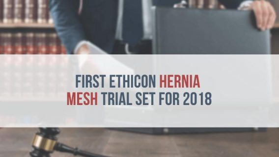 First Ethicon Hernia Mesh Trial Set for 2018