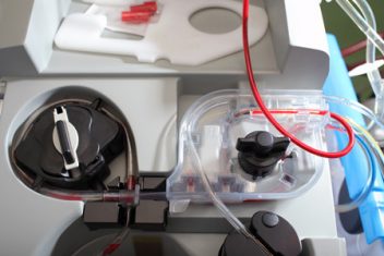 Modern Hemodialysis Machine