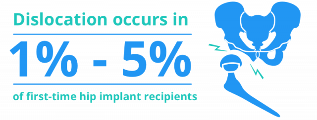 dislocation in 1-5% of first-time hip implant recipients stat