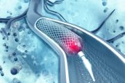 Ten Injuries and One Death Lead to Medtronic Brain Stent Recall