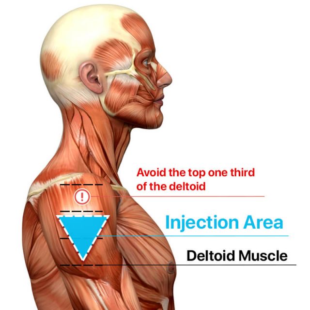 Diagram showing the proper vaccine area