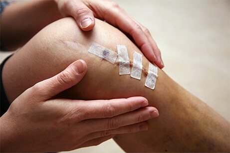 Person Holding Knee with Incision Marks and Bandages