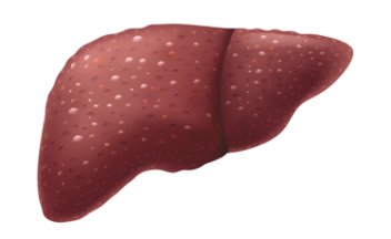 Illustration of liver failure.