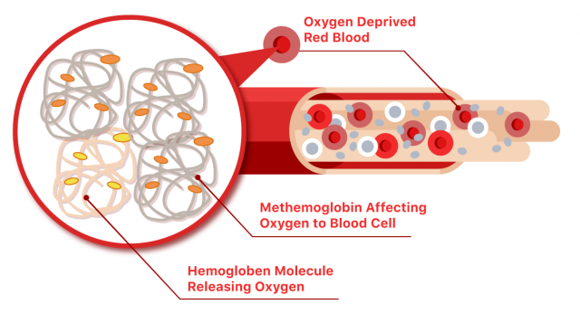 Methemoglobin illustration that shows low oxygen in the blood stream