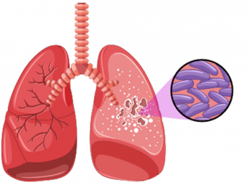Mycobacteria Illustration