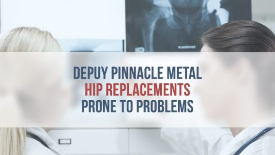 DePuy Pinnacle Metal Hip Replacements Prone to Problems