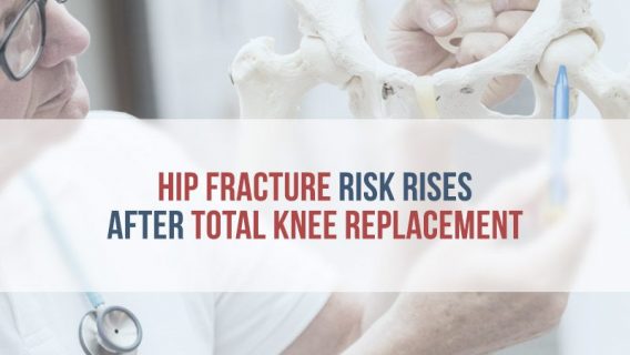 Total Knee Replacement Increases Hip Fracture Risk