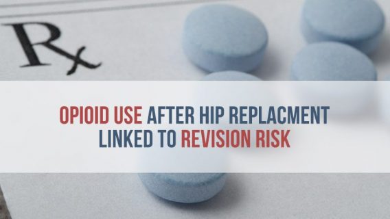 Opioid Use After Hip Replacement Linked to Revision Risk
