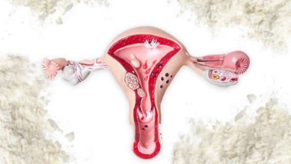 Supplier Settles Talcum Powder Ovarian Cancer Lawsuits