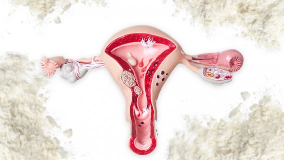 Supplier Settles Talcum Powder Ovarian Cancer Lawsuits