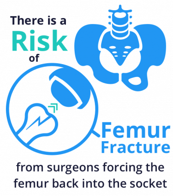 Femur fracture icons