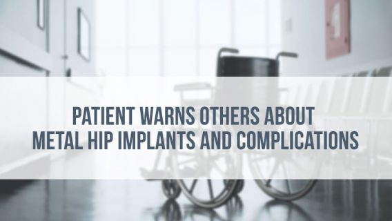 Patient Warns Others About Metal Hip Implants and Complications