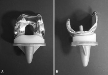 DePuy Attune Rotating Platform Design