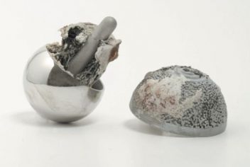 Hip Implant Metal Decomposition