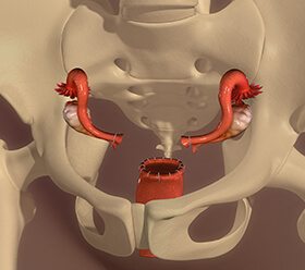 Vaginal Hysterectomy Surgery