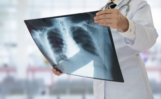 Doctor holding an x-ray