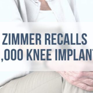 Woman with knee pain